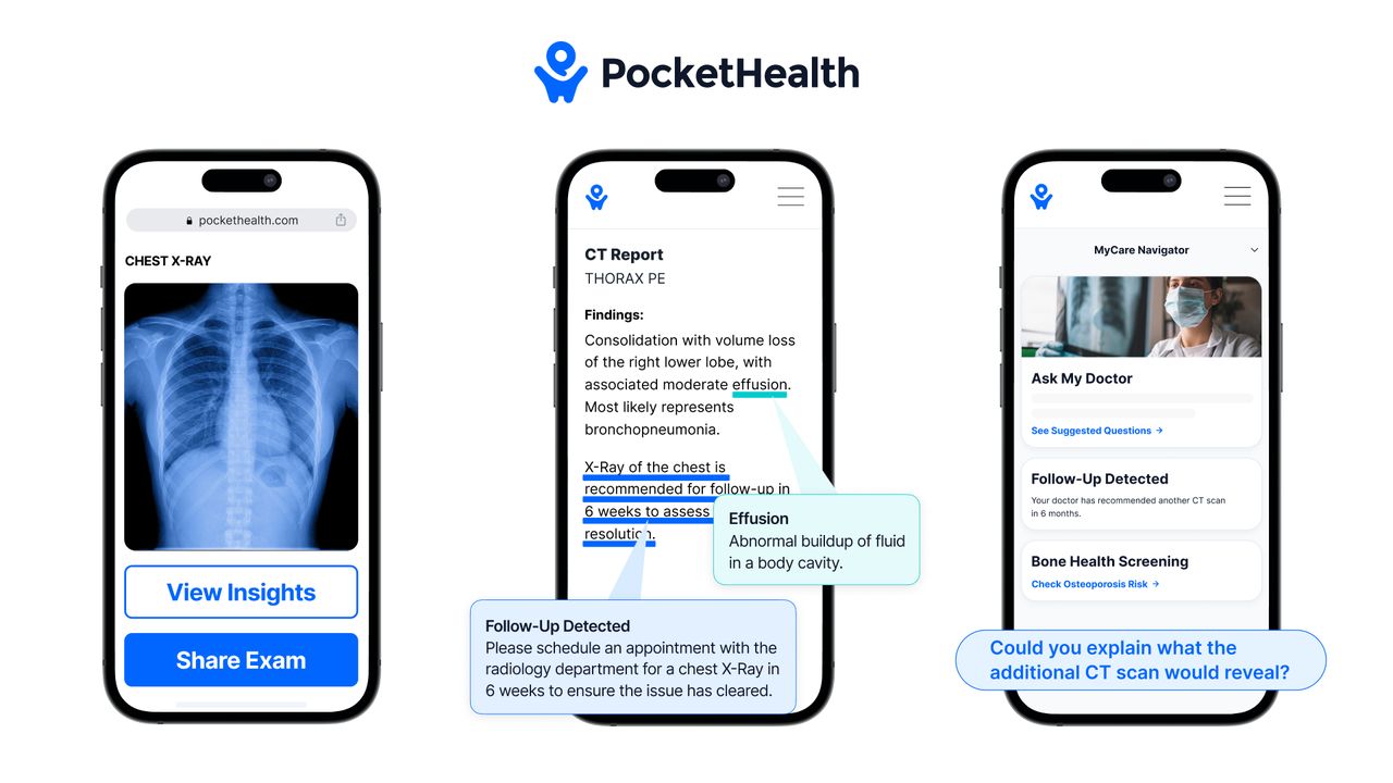 Toronto's PocketHealth expands from image sharing to AI for health care admin